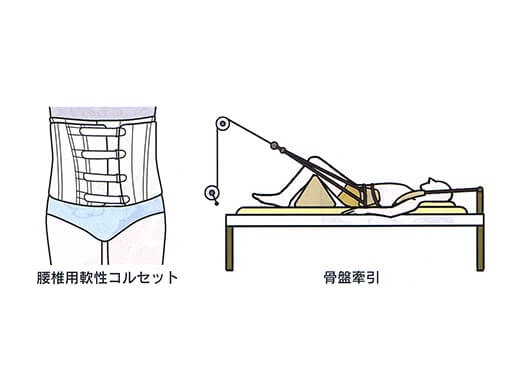 腰椎椎間板ヘルニアの治療法