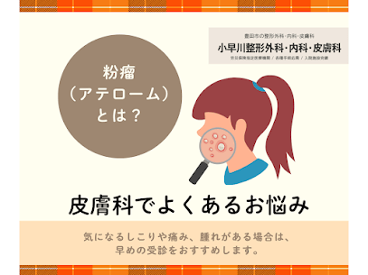 記事のサムネイル画像